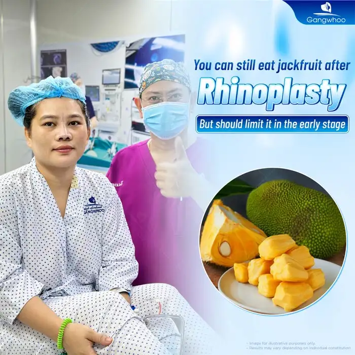 Can you eat jackfruit after rhinoplasty? Is it necessary to avoid it?