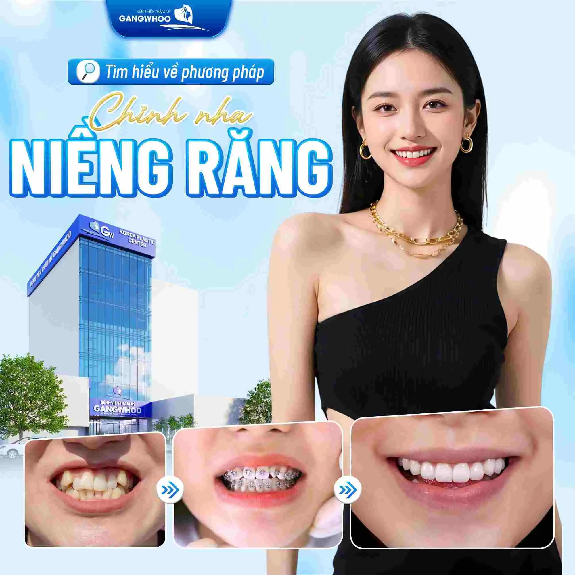 Tìm hiểu về phương pháp chỉnh nha – niềng răng là gì?