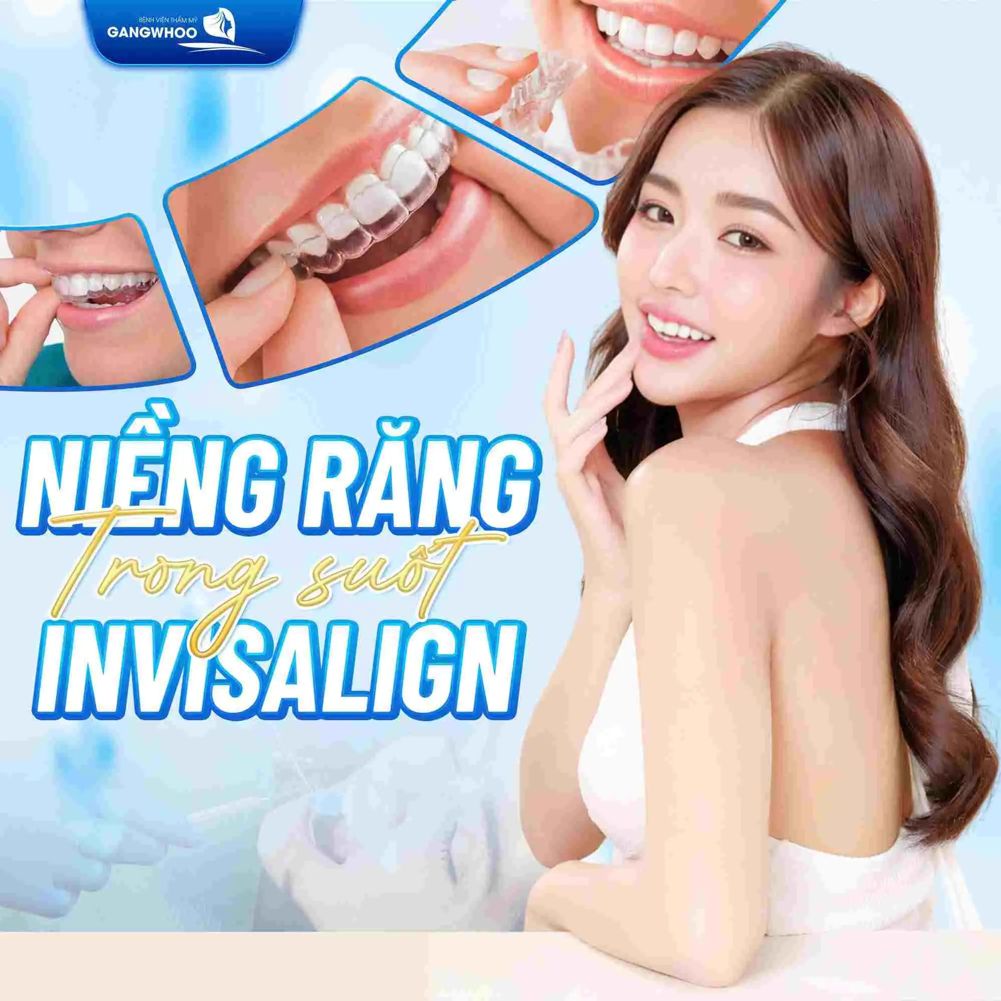 Niềng răng trong suốt Invisalign