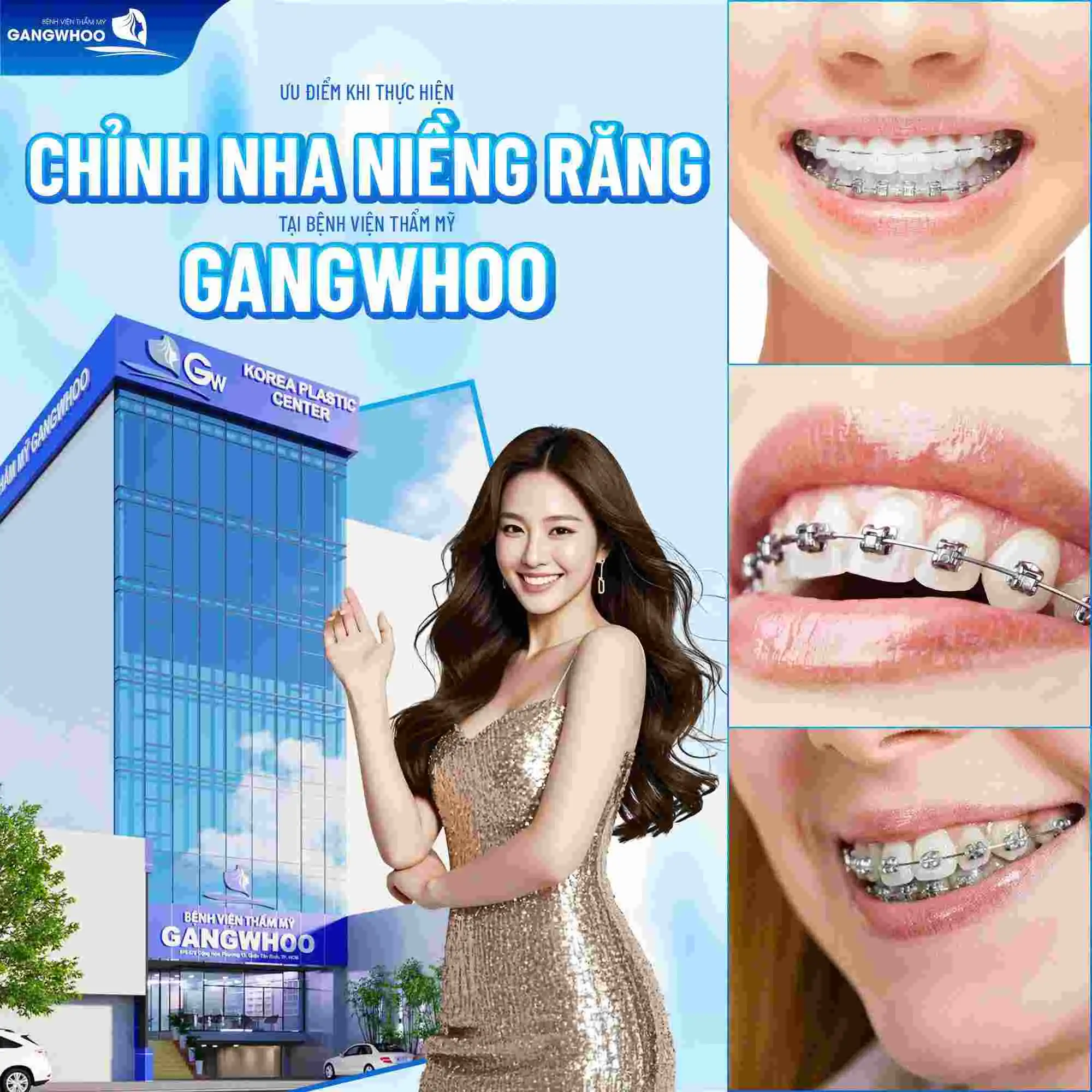Ưu điểm khi thực hiện chỉnh nha niềng răng tại Bệnh viện thẩm mỹ Gangwhoo