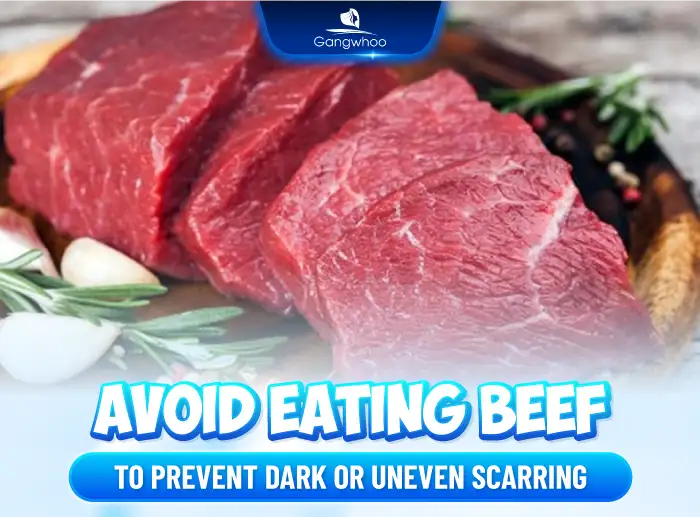 What foods should be avoided after eyelid surgery? How to choose foods to promote faster healing after double eyelid surgery