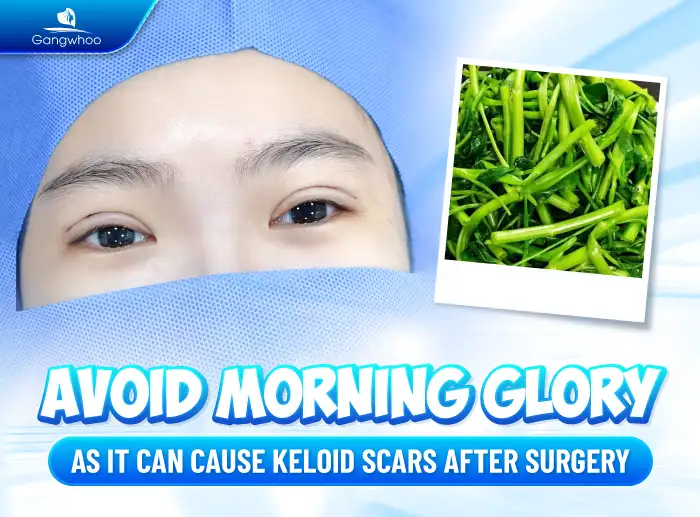 What foods should be avoided after eyelid surgery? How to choose foods to promote faster healing after double eyelid surgery