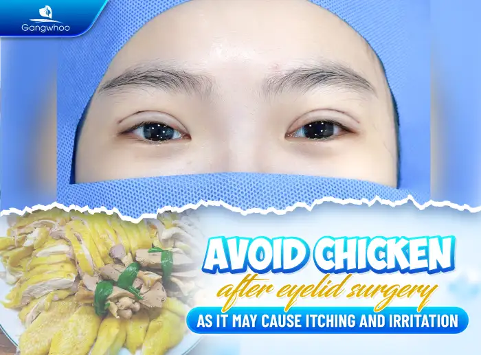 What foods should be avoided after eyelid surgery? How to choose foods to promote faster healing after double eyelid surgery