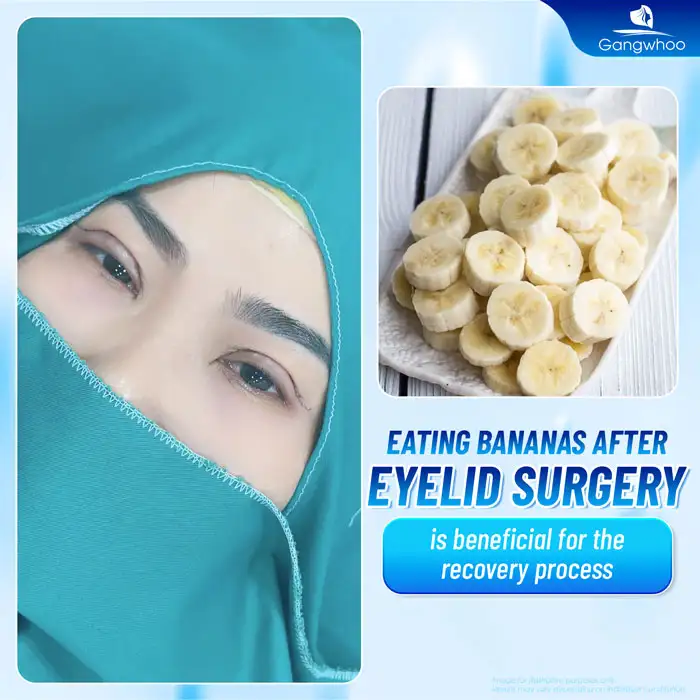 Is it okay to eat bananas after eyelid surgery?