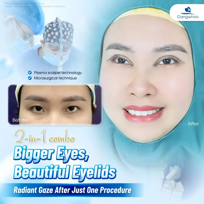 What Is Mini Deep Eyelid Surgery? Should You Choose the Mini Deep Eyelid Technique?