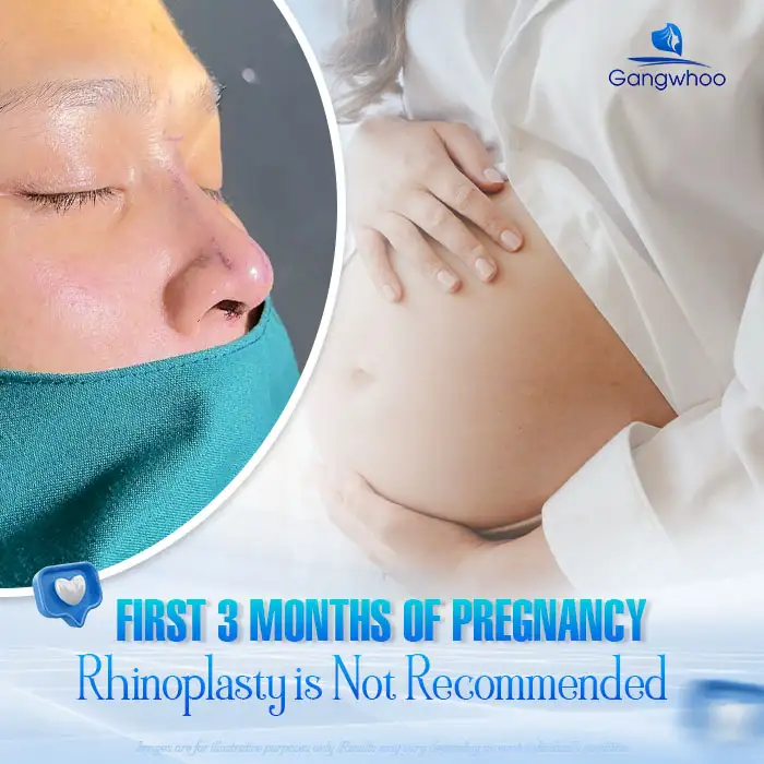 Can you undergo rhinoplasty while pregnant? Does it affect the fetus?