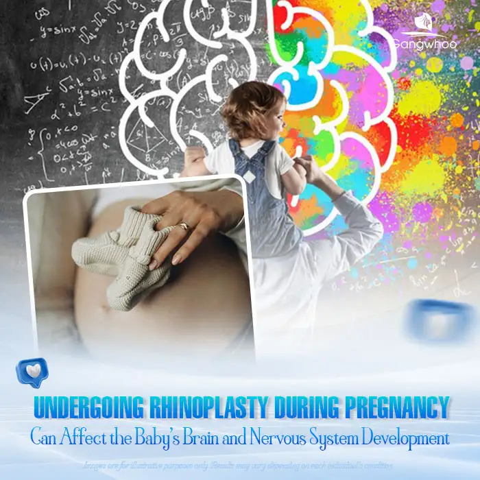 Can you undergo rhinoplasty while pregnant? Does it affect the fetus?