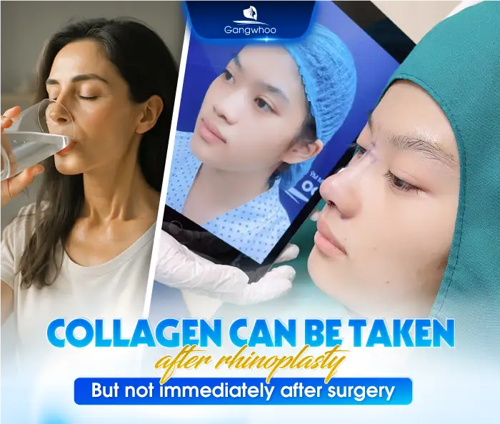 Can You Take Collagen After Rhinoplasty? Important Notes When Supplementing Collagen