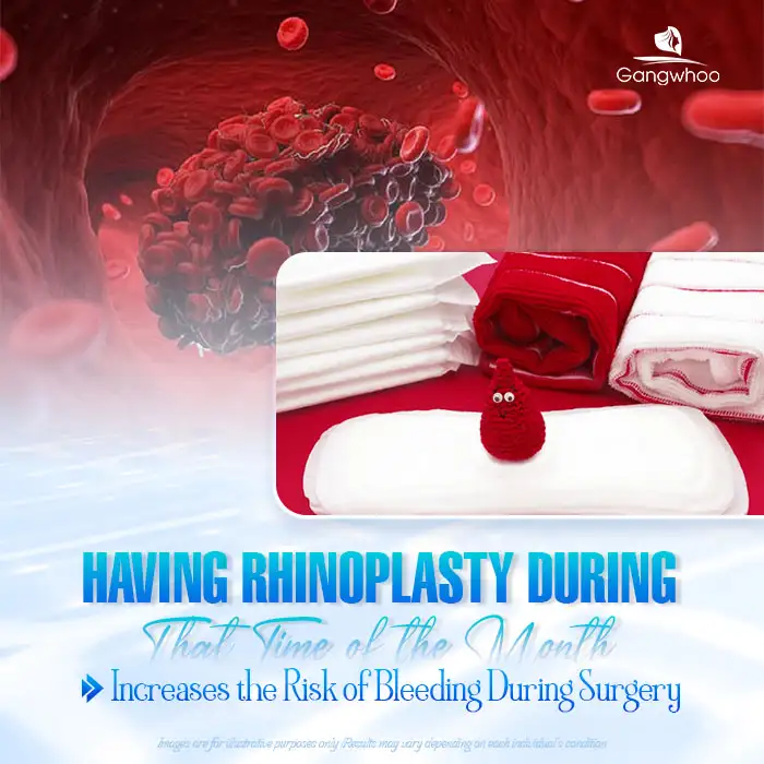 Can you undergo rhinoplasty during menstruation? Should it be avoided?
