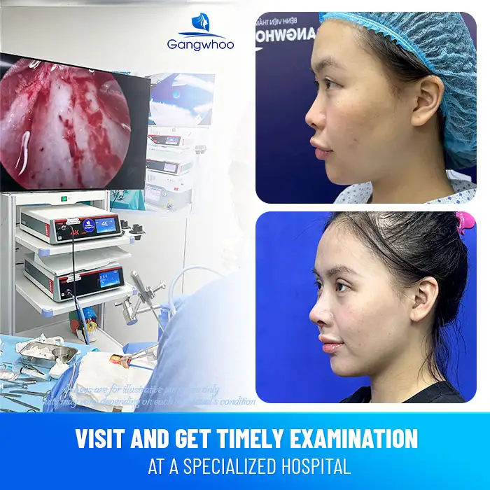 Signs of infection after rhinoplasty and effective treatment methods