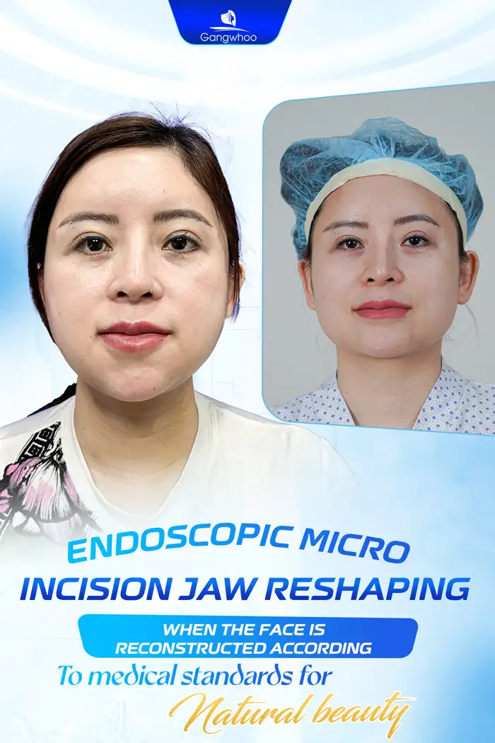 Is jaw shaving painful? Does it cause any complications?