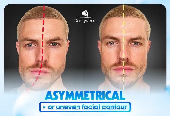 Is jaw shaving dangerous? Should jaw shaving be performed?