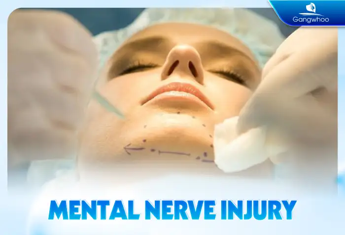 Is jaw shaving dangerous? Should jaw shaving be performed?