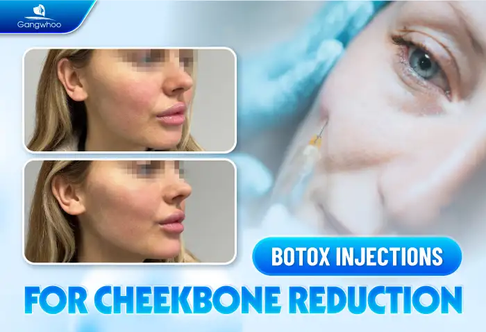 Are there any non-surgical methods to lower the cheekbones? Do the results last long?