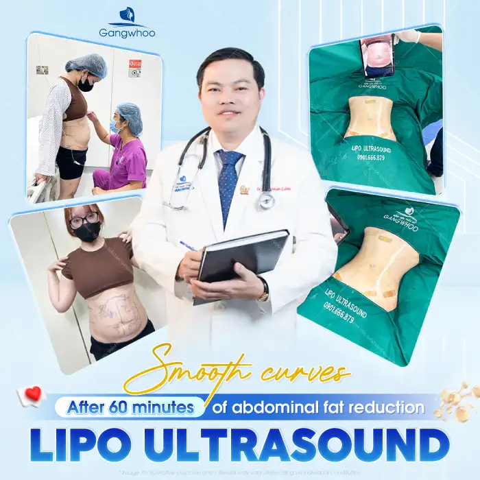 How long does it take for abdominal fat removal to heal and look naturally beautiful? Is downtime required?