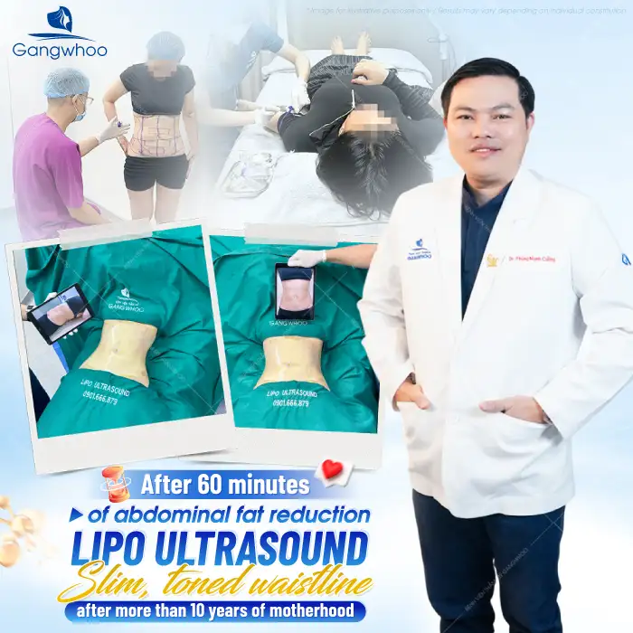 How long does it take for abdominal fat removal to heal and look naturally beautiful? Is downtime required?