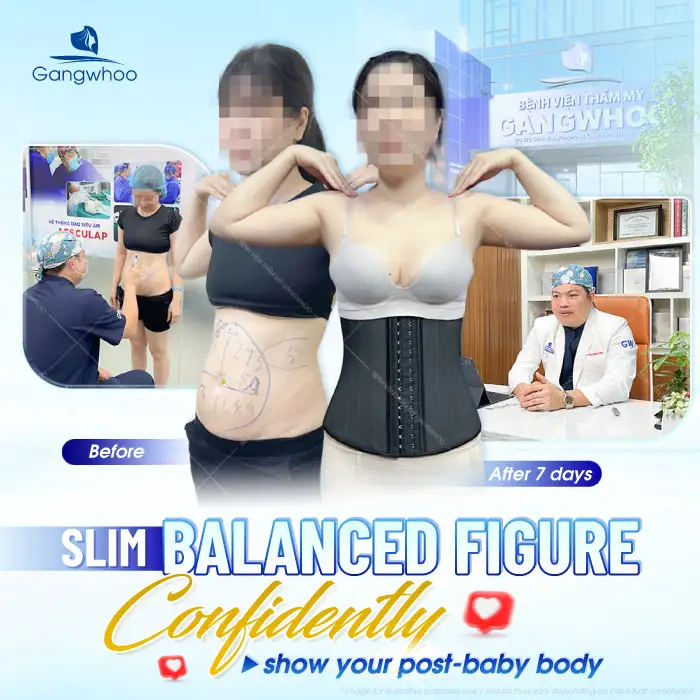 How long does it take for abdominal fat removal to heal and look naturally beautiful? Is downtime required?