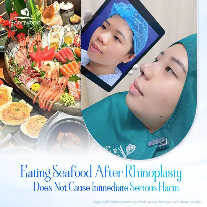 What happens if you accidentally eat seafood after rhinoplasty? Will it have any effects?