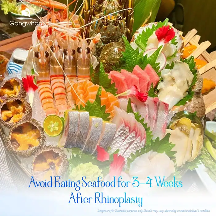 What happens if you accidentally eat seafood after rhinoplasty? Will it have any effects?