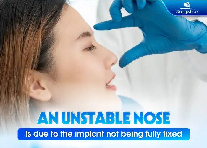 Why does the nose become loose after rhinoplasty? How should it be managed? 1 Why does the nose become loose after rhinoplasty? How should it be managed?
