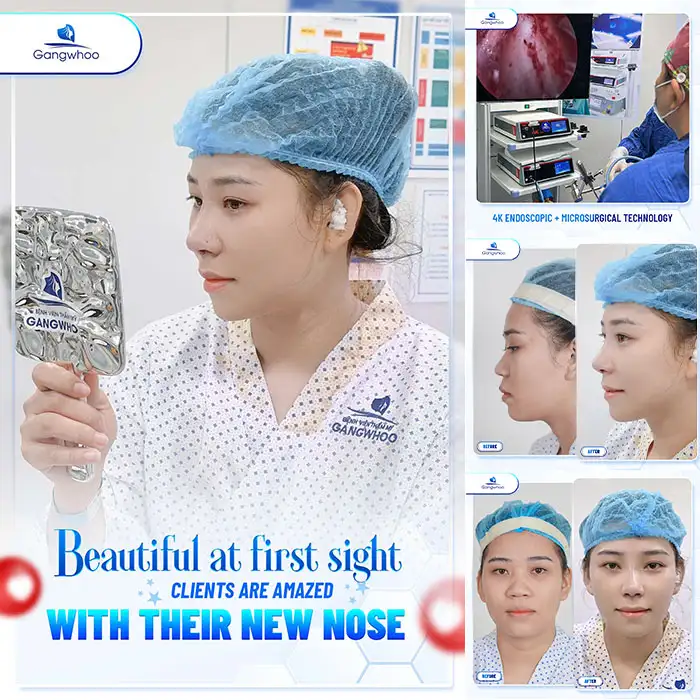 Which rhinoplasty technique is suitable for a flat and upturned nose? Which nose shape is appropriate?