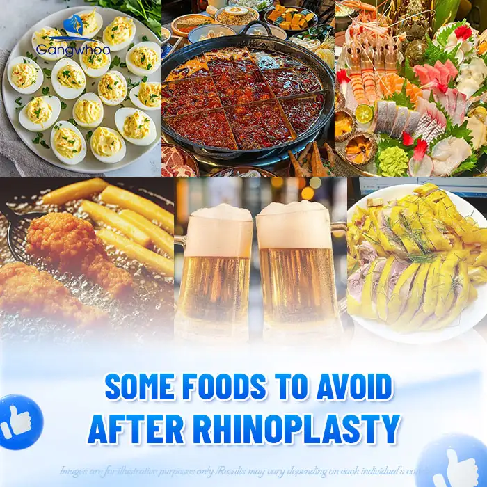 Is it okay to eat salmon after rhinoplasty? When should salmon be eaten?