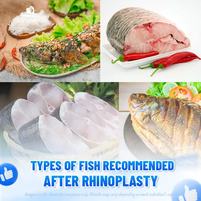Is it okay to eat salmon after rhinoplasty? When should salmon be eaten?