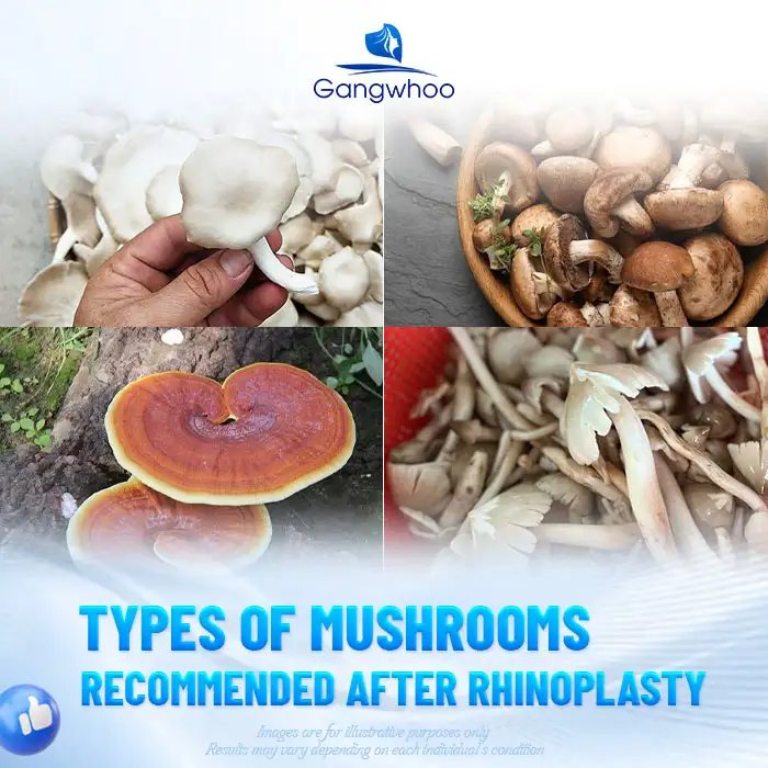 Can you eat straw mushrooms after rhinoplasty? The benefits of straw mushrooms after rhinoplasty
