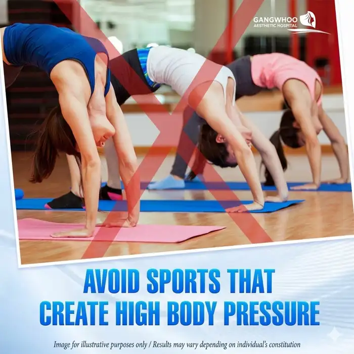 How long after rhinoplasty can you practice yoga? Important notes when practicing yoga 3 How long after rhinoplasty can you practice yoga? Important notes when practicing yoga