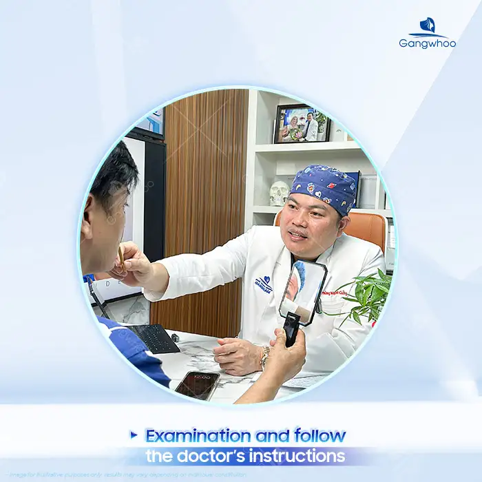 How Long After Rhinoplasty Can Implant Displacement Occur? How to Prevent Implant Displacement After Rhinoplasty