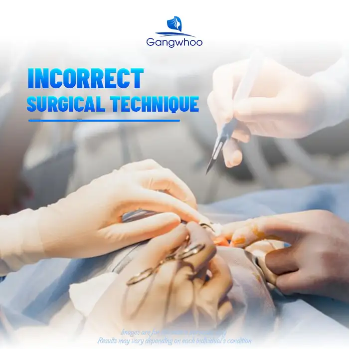 What are the causes of septal perforation after rhinoplasty? How is it managed?