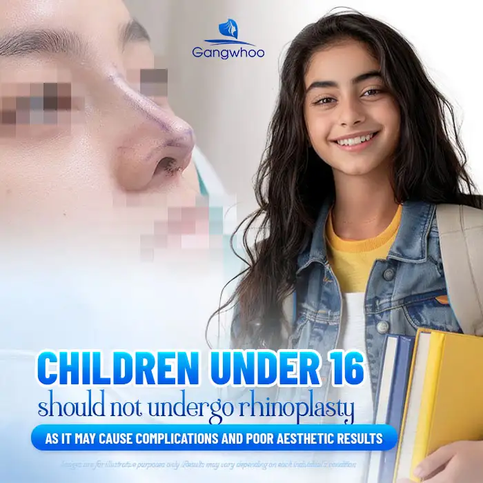 Rhinoplasty for children: Should it be done and what should be considered?