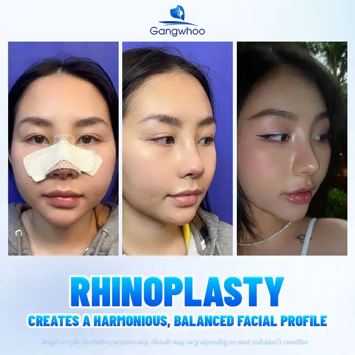 Lưu nháp tự động