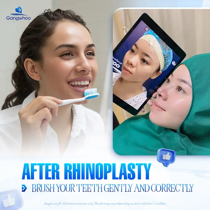 Is it okay to brush your teeth after rhinoplasty? What should be noted when brushing your teeth?