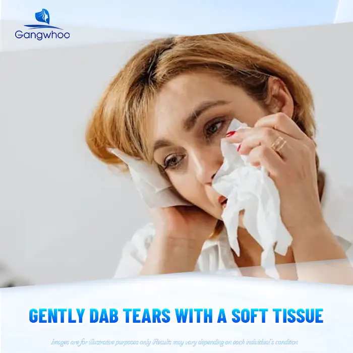 Is it okay to cry after rhinoplasty? Does it affect the nose after surgery? 2 Is it okay to cry after rhinoplasty? Does it affect the nose after surgery?