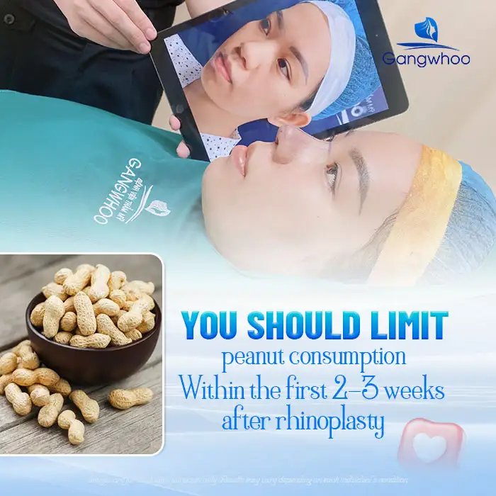 Should you eat peanuts after rhinoplasty? What should you keep in mind when eating them? 1 Lưu nháp tự động