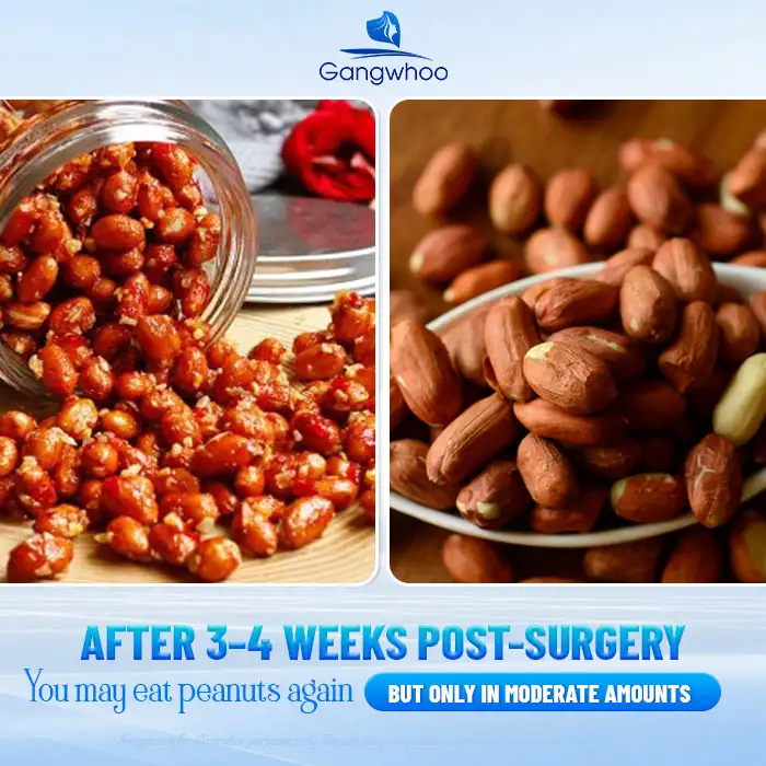 Should you eat peanuts after rhinoplasty? What should you keep in mind when eating them? 2 Lưu nháp tự động