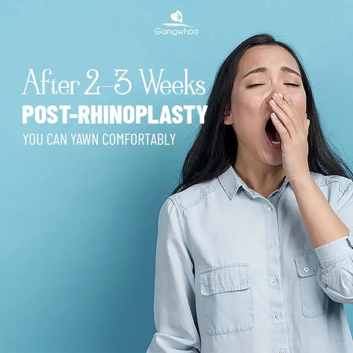Can you yawn after rhinoplasty? Will it affect the nasal shape?