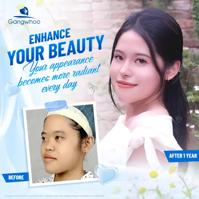 How much does Korean rhinoplasty cost? Updated latest price list for 2026