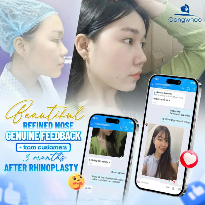 How much does Korean rhinoplasty cost? Updated latest price list for 2026