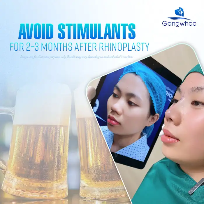 How long should you avoid stimulants after rhinoplasty? What should you keep in mind when using them?