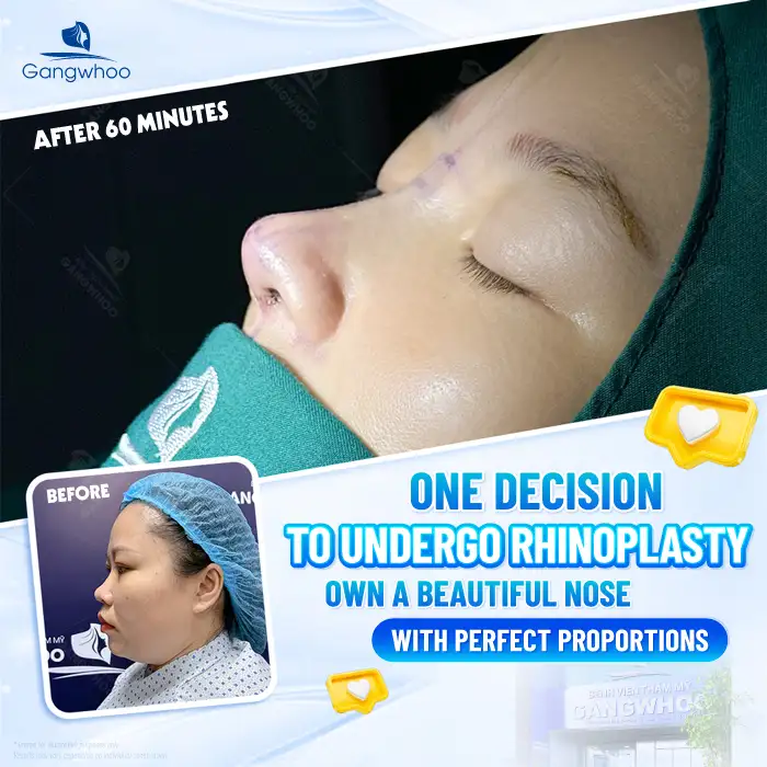 Lưu nháp tự động