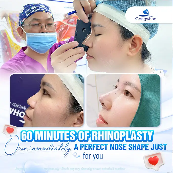 What Is Structural Rhinoplasty? When Should It Be Performed?