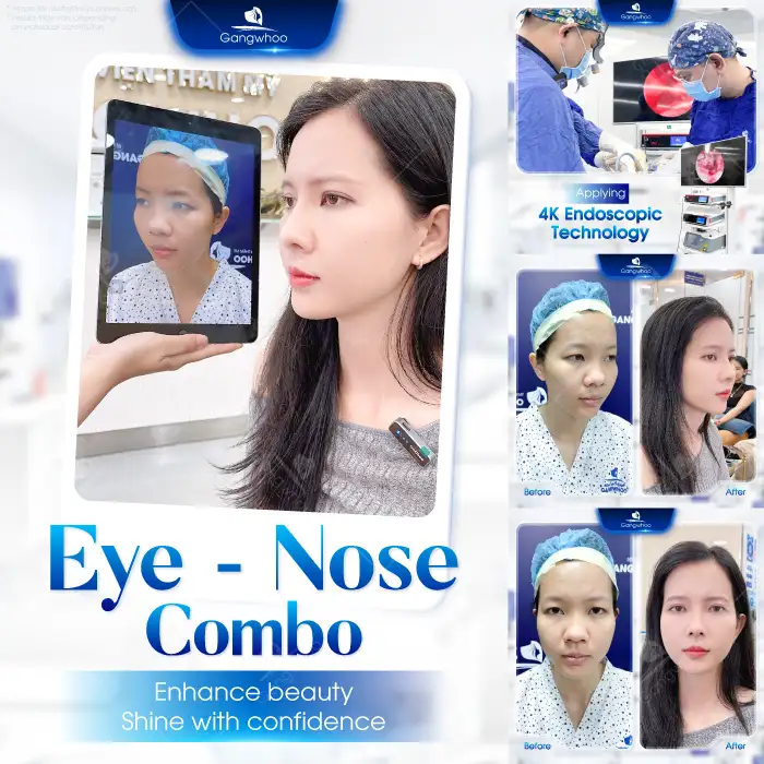 Lưu nháp tự động