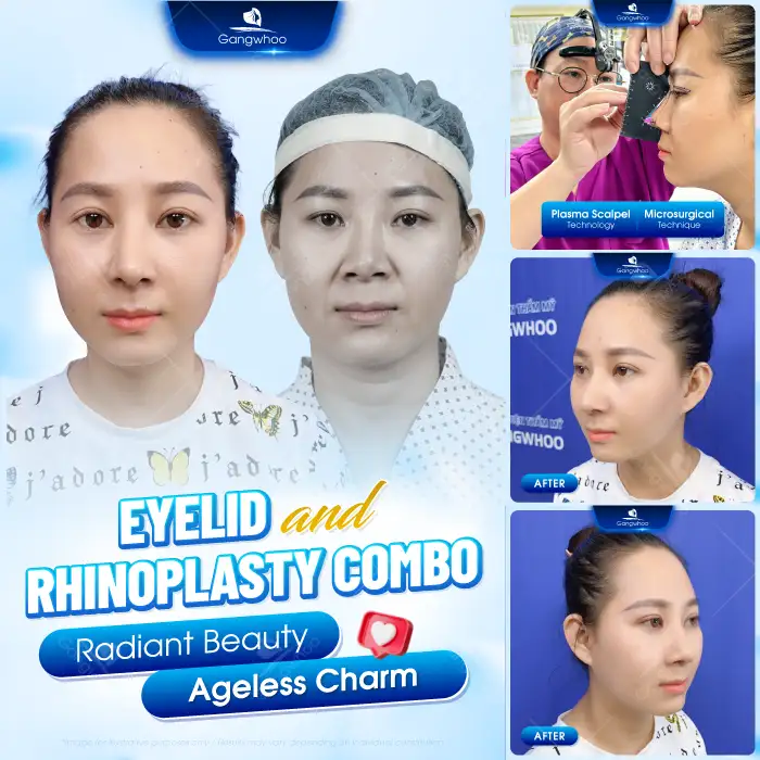 Lưu nháp tự động