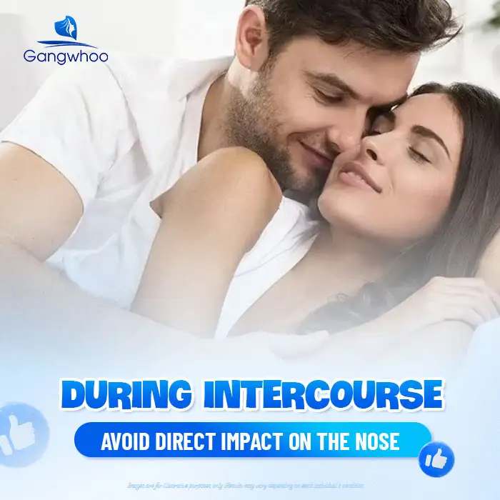 Is it allowed to have sexual intercourse after rhinoplasty? Is abstinence required?