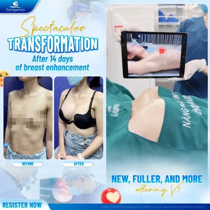 What non-surgical breast augmentation methods are available today?