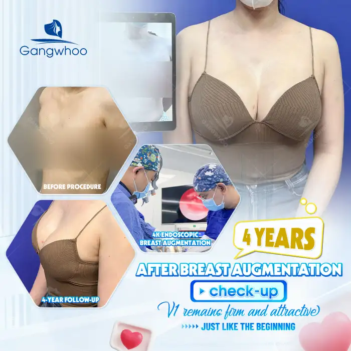What non-surgical breast augmentation methods are available today?