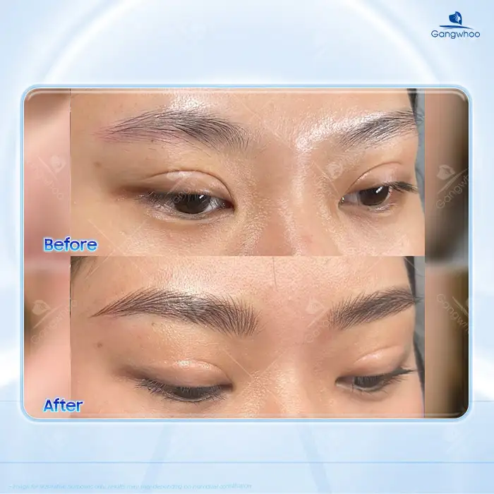 Should You Choose Eyebrow Microblading or Eyebrow Tattooing? A Comparison of Two Methods