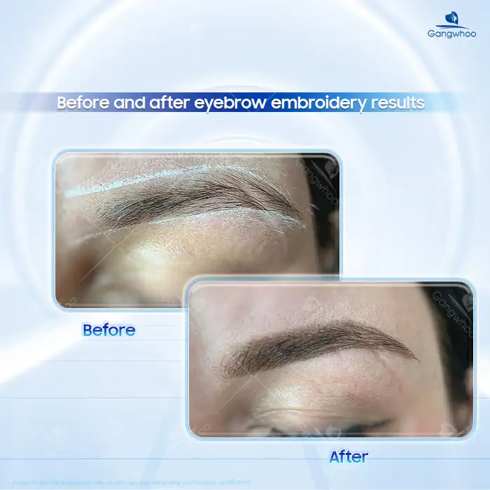 What Should You Avoid After Eyebrow Tattooing? How Long Should You Avoid It?